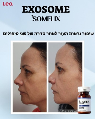 אקסוזומים